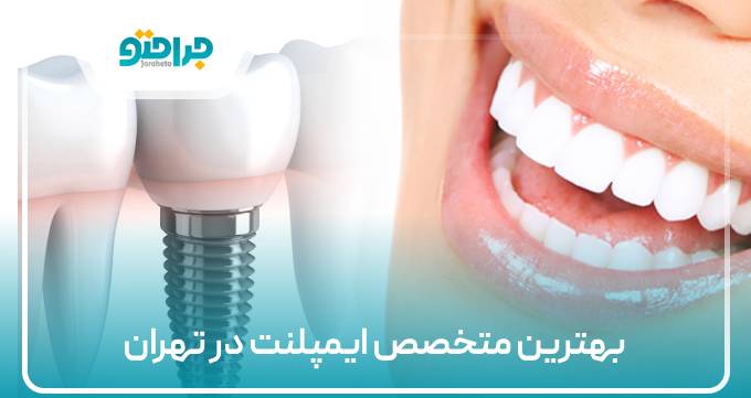 بهترین متخصص ایمپلنت در تهران
