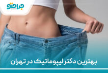 بهترین دکتر لیپوماتیم در تهران
