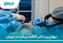 بهترین دکتر کاشت ریشدر تهران