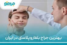 بهترین جراح بلفاروپلاستی در ایران