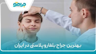 بهترین جراح بلفاروپلاستی در ایران