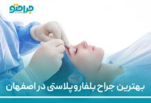 بهترین جراح بلفاروپلاستی در اصفهان