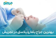 بهترین جراح بلفاروپلاستی در تجریش
