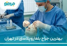 بهترین جراح بلفاروپلاستی در تهران