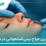 10 تا از بهترین جراح بینی استخوانی در کرج【سال1404】❤️