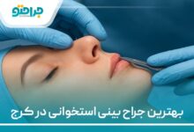 بهترین جراح بینی استخوانی در کرج
