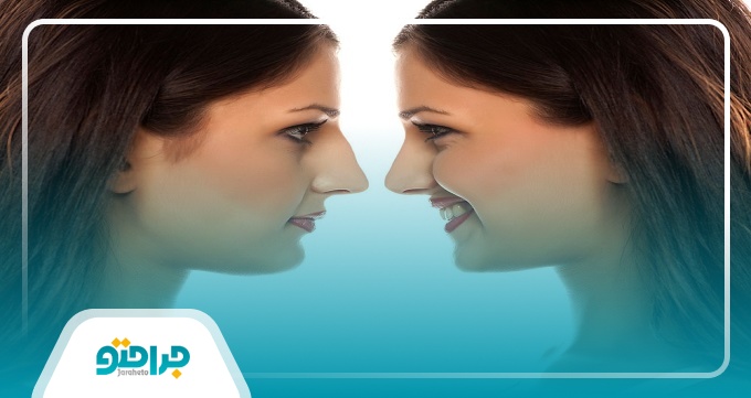 راهنمای رزرو نوبت از بهترین جراح بینی استخوانی در کرج