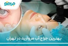 بهترین جراح آب مروارید در تهران