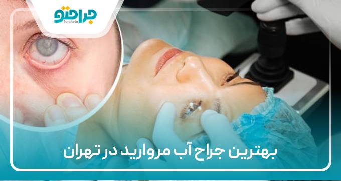 بهترین جراح آب مروارید در تهران