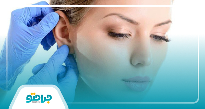 انتخاب بهترین جراح زیبایی گوش در کرج
