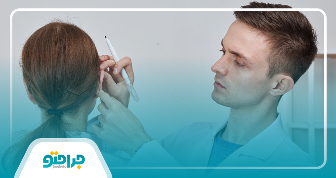 روند انجام جراحی زیبایی گوش