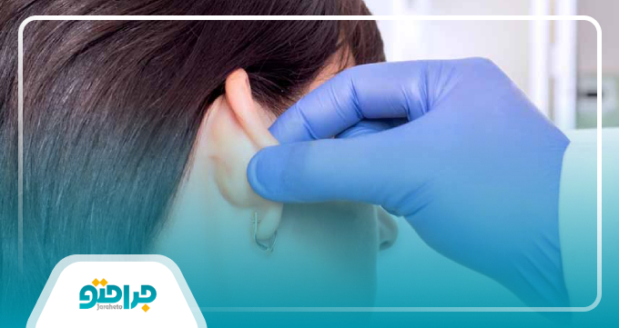 مراقبت های بعد از جراحی زیبایی گوش