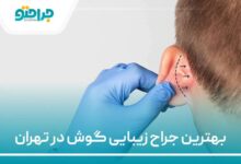 بهترین جراح زیبایی گوش در تهران