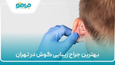 بهترین جراح زیبایی گوش در تهران