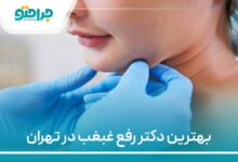 بهترین دکمتر رفقع غبغب در تهران