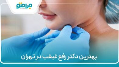 بهترین دکمتر رفقع غبغب در تهران