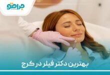 بهترین دکتر فیلر در کرج