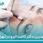 10 تا از بهترین دکتر کاشت ابرو در تهران【سال1404】❤️