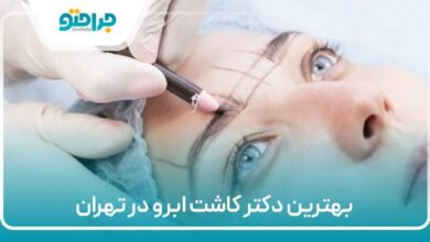 بهترین دکتر کاشت ابرو در تهران