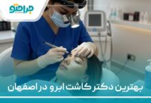 بهترین دکتر کاشت ابرو در اصفهان