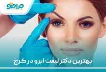 بهترین دکتر لیفت ابرو در کرج