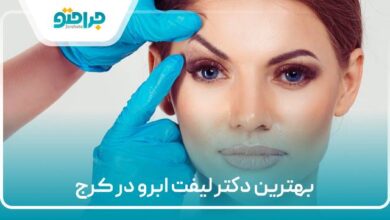 بهترین دکتر لیفت ابرو در کرج