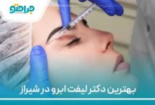 بهترین دکتر لیفت ابرو در شیراز