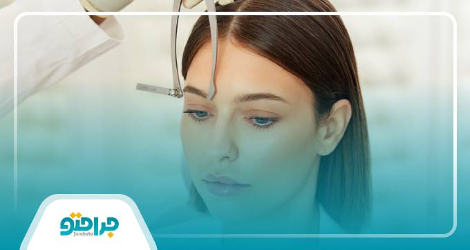 لیفت ابرو چیست؟