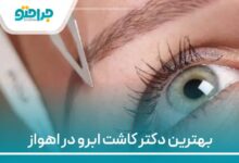 بهترین دکتر کاشت ابرو در اهواز