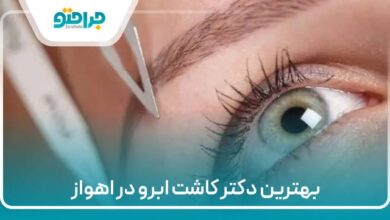 بهترین دکتر کاشت ابرو در اهواز