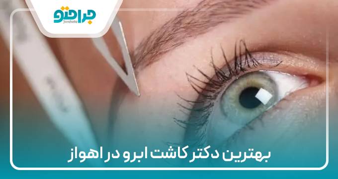 بهترین دکتر کاشت ابرو در اهواز