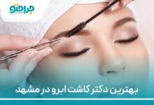 بهترین دکتر کاشت ابرو در مشهد