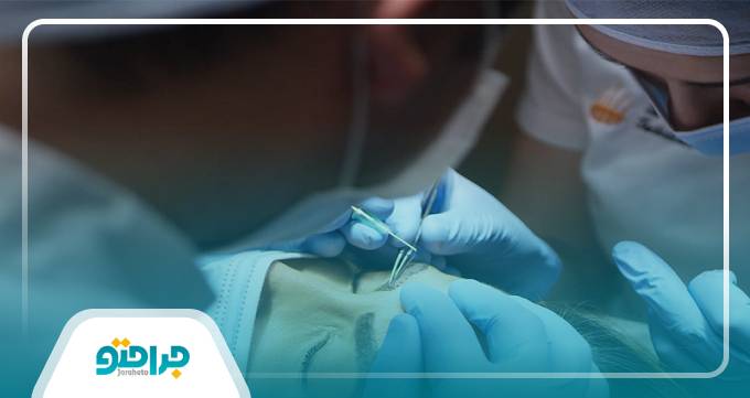 روش های خانگی برای تقویت ابرو