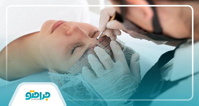هزینه کاشت ابرو چقدر است؟