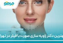 بهترین دکتر زاویه سازی صورت با فیلر در تهران