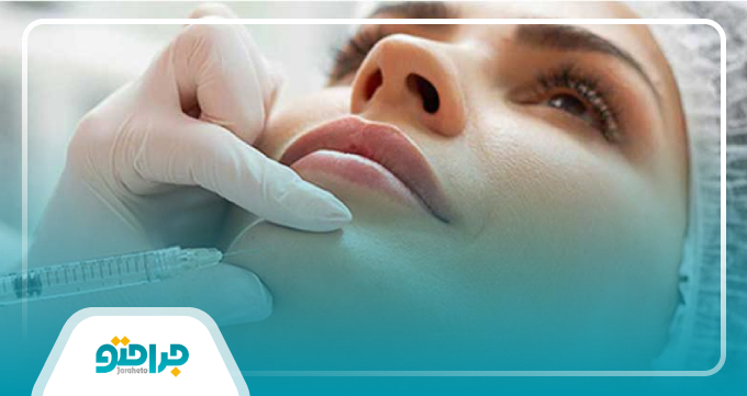 زاویه سازی صورت با فیلر