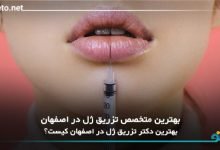 بهترین دکتر تزریق ژل در اصفهان