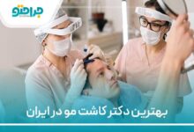 بهترین دکتر کاشت مو در ایران