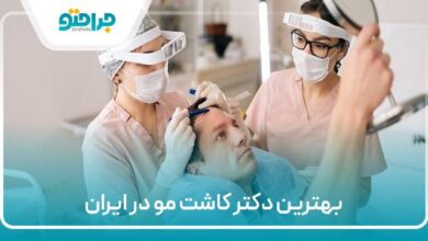 بهترین دکتر کاشت مو در ایران