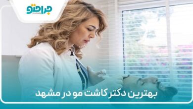 بهترین دکتر کاشت مو در مشهد