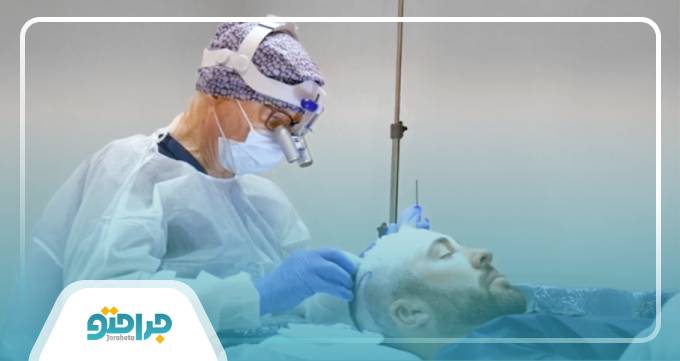 مزایای دریافت نوبت از بهترین دکتر کاشت مو در مشهد