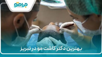 بهترین دکتر کاشت مو در تبریز