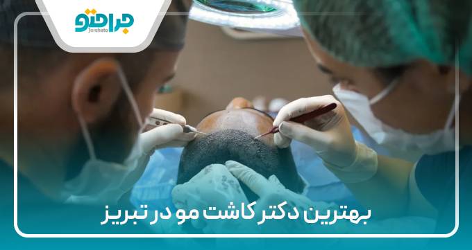 بهترین دکتر کاشت مو در تبریز