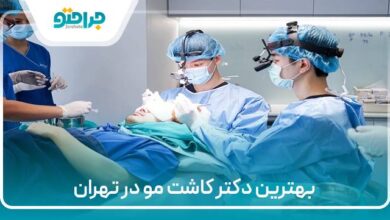 بهترین دکتر کاشت مو در تهران