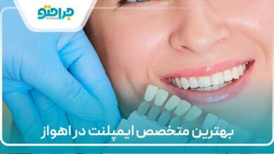 بهترین متخصص ایمپلنت در اهواز