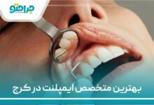 بهترین متخصص ایمپلنت در کرج