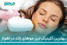 بهترین کلینیک لیزر موهای زائد در اهواز