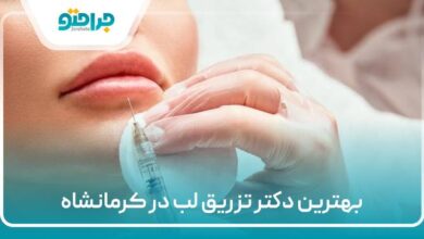 بهترین دکتر تزریق لب در کرمانشاه