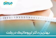 بهترین دکتر لیپوماتیک در رشت