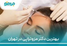 بهترین دکتر مزوتراپی مو در تهران